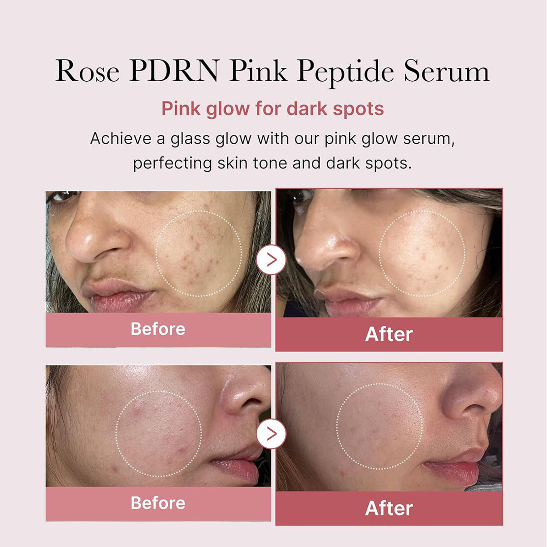 Cross-Border New Product Pink Peptide Collagen Ampoule Essence Pdrn Pink Peptlde Serum